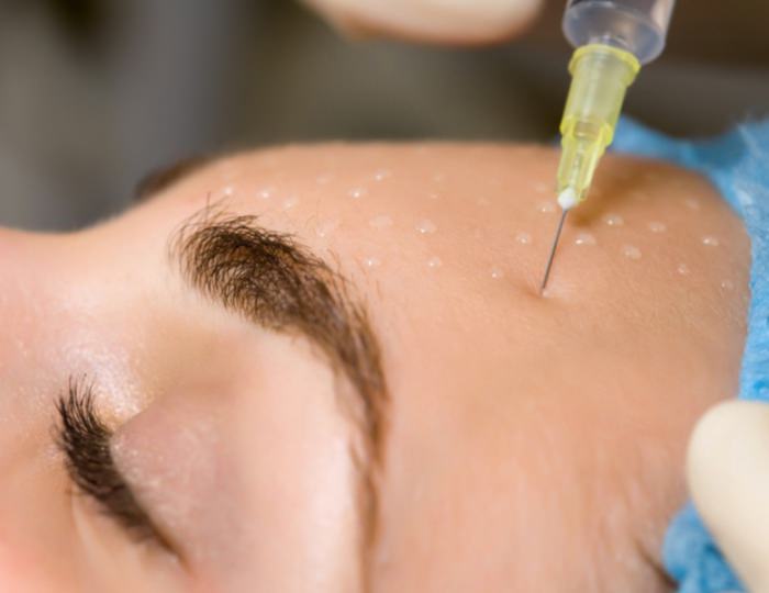 Мезотерапия - Санаторий «Источник» Ессентуки